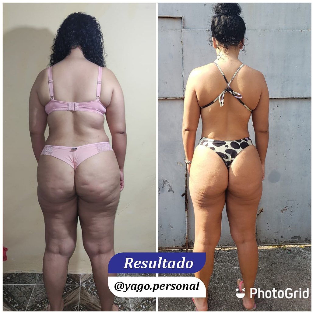antes e depois